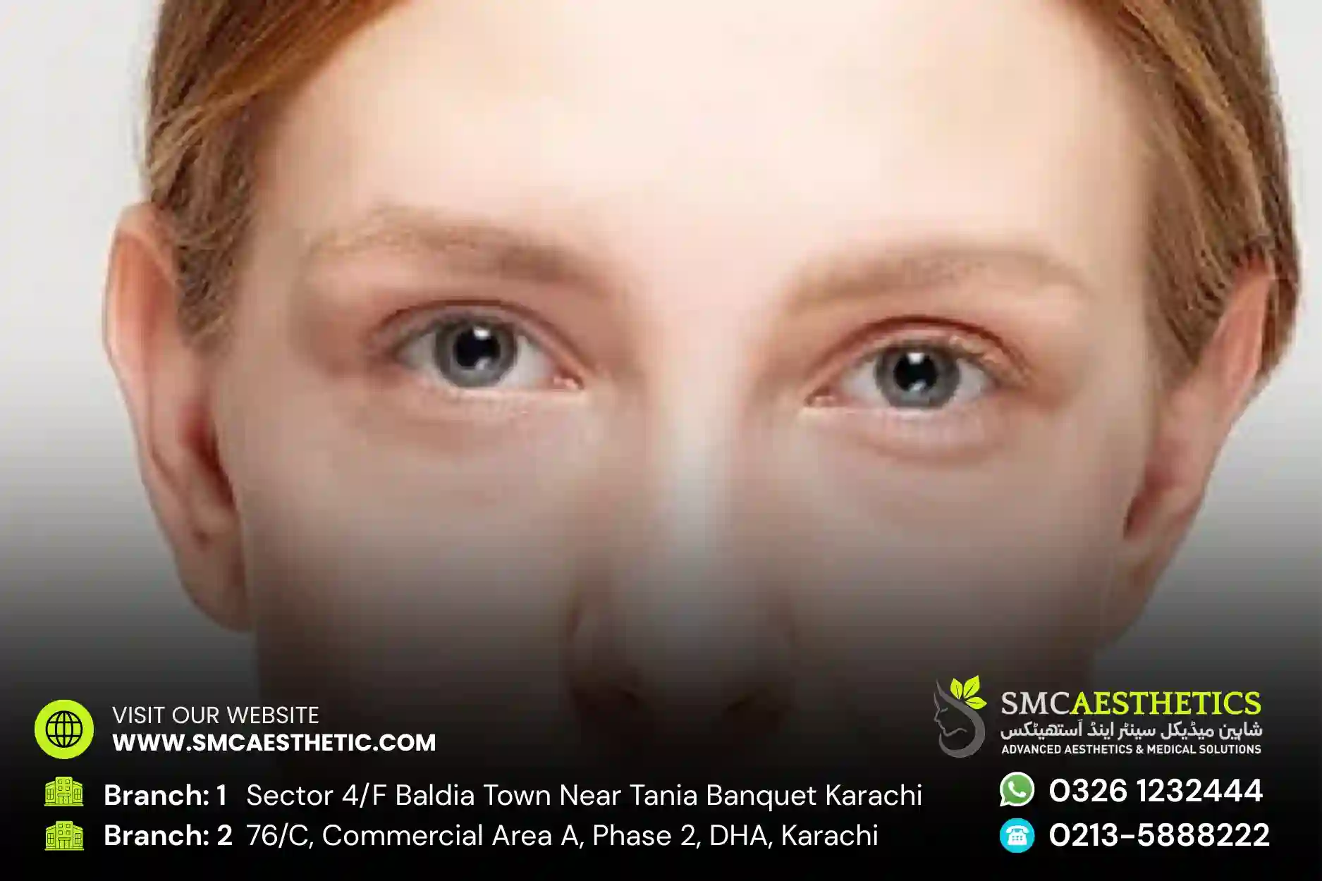 Puffy Eyes Treatment in Karachi - Under-Eye Tightening at SMC Aesthetics